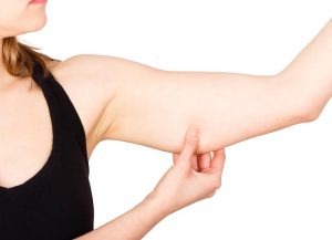 Is arm lift worth it?