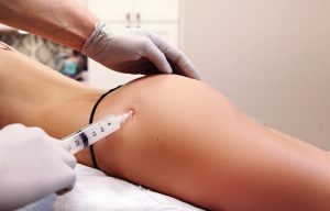 What is a BBL surgery cost?