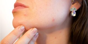 Skin Health