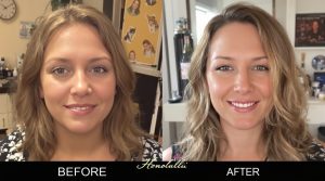custom mommy makeover Honolulu