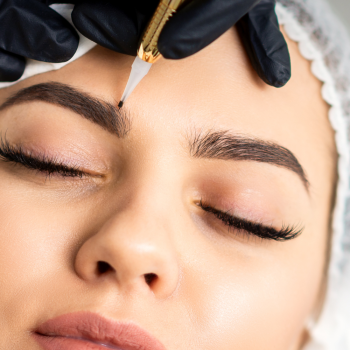 brow surgery