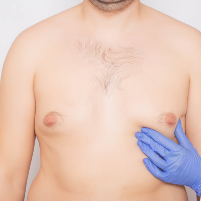 man breast